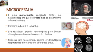 MICROCEFALIA
 É uma má-formação congênita (antes do
nascimento) em que o cérebro não se desenvolve
adequadamente.
 Primeiro Indício é o tamanho;
 São realizados exames neurológicos para checar
alterações no desenvolvimento do cérebro.
 Crianças com microcefalia, podem ter dificuldades
respiratórias e motoras em diferentes graus.
 