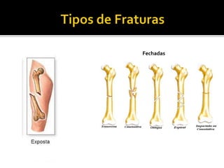 Fechadas
 
