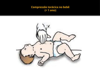 Compressão torácica no bebê
(< 1 ano):
 
