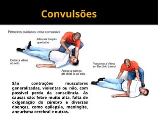 Convulsões
São contrações musculares
generalizadas, violentas ou não, com
possível perda da consciência. As
causas são: febre muito alta, falta de
oxigenação do cérebro e diversas
doenças, como epilepsia, meningite,
aneurisma cerebral e outras.
 