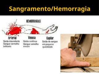 Sangramento/Hemorragia
 