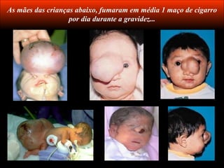 As mães das crianças abaixo, fumaram em média 1 maço de cigarro
                   por dia durante a gravidez...
 