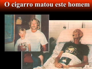 O cigarro matou este homem
 