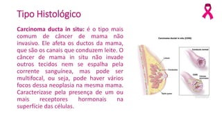 Tipo Histológico
Carcinoma ducta in situ: é o tipo mais
comum de câncer de mama não
invasivo. Ele afeta os ductos da mama,
que são os canais que conduzem leite. O
câncer de mama in situ não invade
outros tecidos nem se espalha pela
corrente sanguínea, mas pode ser
multifocal, ou seja, pode haver vários
focos dessa neoplasia na mesma mama.
Caracterizase pela presença de um ou
mais receptores hormonais na
superfície das células.
 