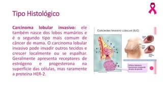 Tipo Histológico
Carcinoma lobular invasivo: ele
também nasce dos lobos mamários e
é o segundo tipo mais comum de
câncer de mama. O carcinoma lobular
invasivo pode invadir outros tecidos e
crescer localmente ou se espalhar.
Geralmente apresenta receptores de
estrógeno e progesterona na
superfície das células, mas raramente
a proteína HER-2.
 
