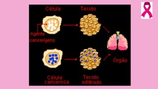 Palestra sobre Cânce do cólo do Útero e Câncer de Mama