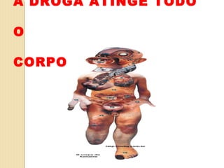 A DROGA ATINGE TODO

O

CORPO
 