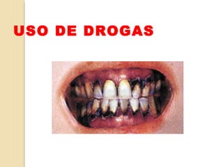 USO DE DROGAS
 