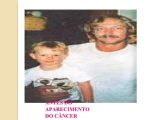 ANTES DO
APARECIMENTO
DO CÂNCER
 