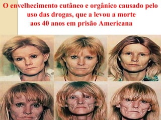 O envelhecimento cutâneo e orgânico causado pelo
       uso das drogas, que a levou a morte
        aos 40 anos em prisão Americana
 