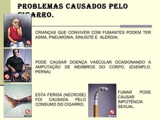 PROBLEMAS CAUSADOS PELO
CIGARRO.

   CRIANÇAS QUE CONVIVEM COM FUMANTES PODEM TER
   ASMA, PNEUMONIA, SINUSITE E ALERGIA;




   PODE CAUSAR DOENÇA VASCULAR OCASIONANDO A
   AMPUTAÇÃO DE MEMBROS DO CORPO. (EXEMPLO:
   PERNA)




                                  FUMAR    PODE
   ESTA FERIDA (NECROSE)
                                  CAUSAR
   FOI   CAUSADA    PELO
                                  IMPOTÊNCIA
   CONSUMO DO CIGARRO;
                                  SEXUAL.
 