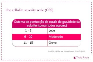 The cellulite severity scale (CSS)
Hexsel DM et al. J Eur Acad Dermatol Venereol. 2009;23(5):523–528
 