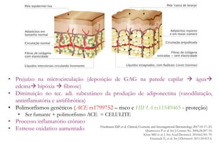 • Prejuízo na microcirculação (deposição de GAG na parede capilar  água
edema hipóxia  fibrose)
• Diminuição no tec. adi. subcutâneo da produção de adiponectina (vasodilatação,
antinflamatória e antifibrótica)
• Polimorfismos genéticos (ACE rs1799752 – risco e HIF1A rs11549465 - proteção)
• Ser fumante + polimorfismo ACE = CELULITE
• Processo inflamatório crônico
• Estresse oxidativo aumentado Friedmann D.P. et al. Clinical, Cosmetic and Investigational Dermatology 2017:10 17–23.
Quatresooz P et al. Int J Cosmet Sci. 2006;28:207-10.
Khan MH et al. J Am Acad Dermatol. 2010;62:361-70.
Emanuele E, et al. Int J Dermatol. 2011;50:412-6.
 