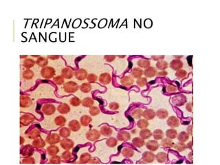 TRIPANOSSOMA NO
SANGUE
 