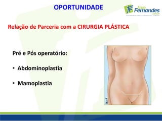 OPORTUNIDADE 
Relação de Parceria com a CIRURGIA PLÁSTICA 
Pré e Pós operatório: 
• Abdominoplastia 
• Mamoplastia 
 