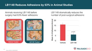 28
LB1148 dramatically reduces the
number of post-surgical adhesions
LB1148 Reduces Adhesions by 63% in Animal Studies
Animals receiving LB1148 before
surgery had 63% fewer adhesions
Source: LBS-NC-IL-ADH-0003 DOF
 