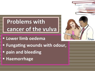 Problems	
  with	
  
cancer	
  of	
  the	
  vulva	
  
§  Lower	
  limb	
  oedema	
  
§  Funga%ng	
  wounds	
  with	
  od...