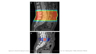 Guide to Palliative Radiotherapy in Advanced Cancer Care | PPTX
