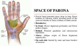 SPACE OF PARONA
• Fascial lined potential space deep to long flexor
tendons of forearm, where proximal parts of the
synovial sheaths of flexor tendons of hand extend.
• Boundaries:
• In front: Flexor digitorum profundus and flexor
pollicis longus
• Behind: Pronator quadratus and interosseous
membrane
• Above: oblique origin of flexor digitorum
superficialis
• On each side: limited by outer and inner borders
of forearm
 