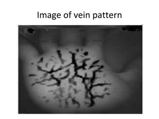 Image of vein pattern 
 
