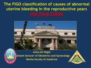 The FIGO classification of causes of abnormal
uterine bleeding in the reproductive years
(the PALM-COEIN)
 