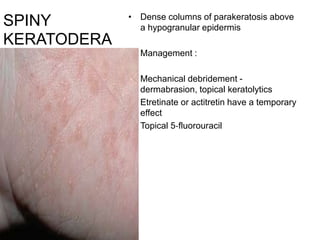 SPINY
KERATODERA
• Dense columns of parakeratosis above
a hypogranular epidermis
• Management :
• Mechanical debridement -
dermabrasion, topical keratolytics
• Etretinate or actitretin have a temporary
effect
• Topical 5‐fluorouracil
 
