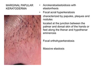 MARGINAL PAPULAR
KERATODERMA
• Acrokeratoelastoidosis with
elastorrhexis
• Focal acral hyperkeratosis
• characterized by papules, plaques and
nodules
• located at the junction between the
palmar and dorsal skin of the hands or
feet along the thenar and hypothenar
eminences
• Focal orthohyperkeratosis
• Massive elastosis
 