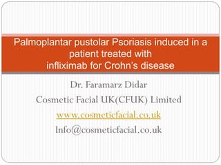 Dr. Faramarz Didar
Cosmetic Facial UK(CFUK) Limited
www.cosmeticfacial.co.uk
Info@cosmeticfacial.co.uk
Palmoplantar pustolar Psoriasis induced in a
patient treated with
infliximab for Crohn’s disease
 