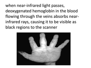 when near-infrared light passes,
deoxygenated hemoglobin in the blood
flowing through the veins absorbs near-
infrared rays, causing it to be visible as
black regions to the scanner
 
