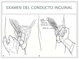EXAMEN DEL CONDUCTO INGUINAL

 