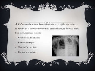  Enfisema subcutáneo: Presencia de aire en el tejido subcutáneo y
se percibe en la palpación como finas crepitaciones, se desplaza hacia
fosa supraclavicular y cuello.
- Neumotórax traumático
- Ruptura esofágica
- Ventilación mecánica
- Fístulas bronquiales
 