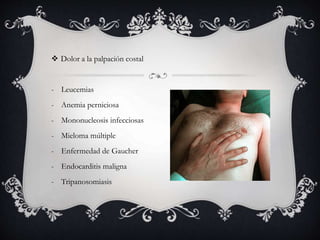  Dolor a la palpación costal
- Leucemias
- Anemia perniciosa
- Mononucleosis infecciosas
- Mieloma múltiple
- Enfermedad de Gaucher
- Endocarditis maligna
- Tripanosomiasis
 