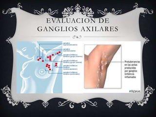 EVALUACION DE
GANGLIOS AXILARES
 