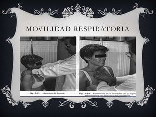 MOVILIDAD RESPIRATORIA
 
