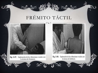 FRÉMITO TÁCTIL
 