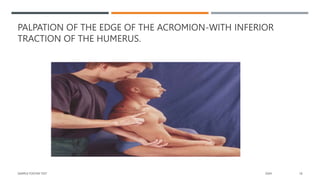 PALPATION OF THE EDGE OF THE ACROMION-WITH INFERIOR
TRACTION OF THE HUMERUS.
SAMPLE FOOTER TEXT 20XX 18
 
