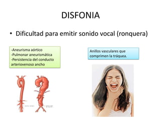 DISFONIA
• Dificultad para emitir sonido vocal (ronquera)

-Aneurisma aórtico                Anillos vasculares que
-Pulmonar aneurismática           comprimen la tráquea.
-Persistencia del conducto
arteriovenoso ancho
 
