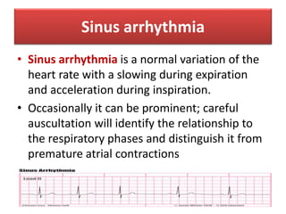Sinus arrhythmia
• Sinus arrhythmia is a normal variation of the
heart rate with a slowing during expiration
and acceleration during inspiration.
• Occasionally it can be prominent; careful
auscultation will identify the relationship to
the respiratory phases and distinguish it from
premature atrial contractions
 