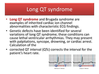 Long QT syndrome
• Long QT syndrome and Brugada syndrome are
examples of inherited cardiac ion channel
abnormalities with characteristic ECG findings.
• Genetic defects have been identified for several
variations of long QT syndrome; these conditions can
cause lethal ventricular arrhythmias. They may present
with palpitations, syncope, drowning, or cardiac arrest.
Calculation of the
• corrected QT interval (QTc) corrects the interval for the
patient’s heart rate.
 