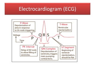 Electrocardiogram (ECG)
 