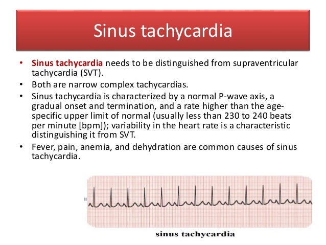 Palpitation In Children