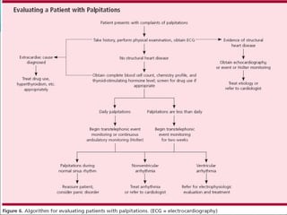 Palpitations Racgp Palpitations | PPT