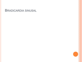 BRADICARDIA SINUSAL
 