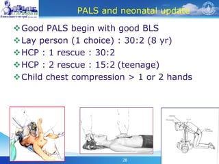28
PALS and neonatal update
Good PALS begin with good BLS
Lay person (1 choice) : 30:2 (8 yr)
HCP : 1 rescue : 30:2
HCP : 2 rescue : 15:2 (teenage)
Child chest compression > 1 or 2 hands
 