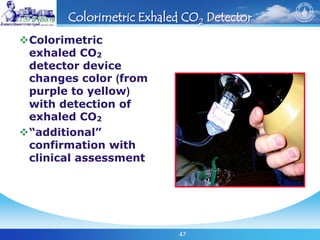 47
Colorimetric Exhaled CO2 Detector
Colorimetric
exhaled CO2
detector device
changes color (from
purple to yellow)
with detection of
exhaled CO2
“additional”
confirmation with
clinical assessment
 