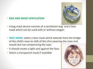 • BAG AND MASK VENTILATION
• A bag mask device consists of a ventilation bag and a face
mask which can be used with or without oxygen
• FACE MASK: select a face mask which extends from the bridge
of the child’s nose to cleft of the chin covering the nose and
mouth but not compressing the eyes
• It should create a tight seal against the face.
• Select a transparent mask if available
 