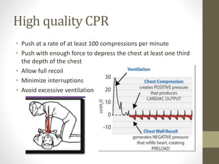 High quality CPR
• Push at a rate of at least 100 compressions per minute
• Push with enough force to depress the chest at least one third
the depth of the chest
• Allow full recoil
• Minimize interruptions
• Avoid excessive ventilation
 