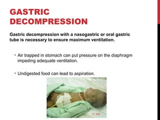 GASTRIC
DECOMPRESSION
Gastric decompression with a nasogastric or oral gastric
tube is necessary to ensure maximum ventilation.
• Air trapped in stomach can put pressure on the diaphragm
impeding adequate ventilation.
• Undigested food can lead to aspiration.
 