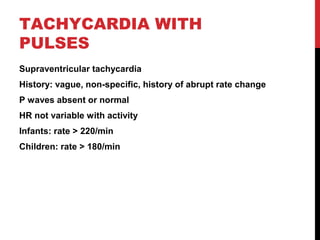 TACHYCARDIA WITH
PULSES
Supraventricular tachycardia
History: vague, non-specific, history of abrupt rate change
P waves absent or normal
HR not variable with activity
Infants: rate > 220/min
Children: rate > 180/min
 