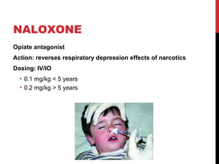 NALOXONE
Opiate antagonist
Action: reverses respiratory depression effects of narcotics
Dosing: IV/IO
• 0.1 mg/kg < 5 years
• 0.2 mg/kg > 5 years
 